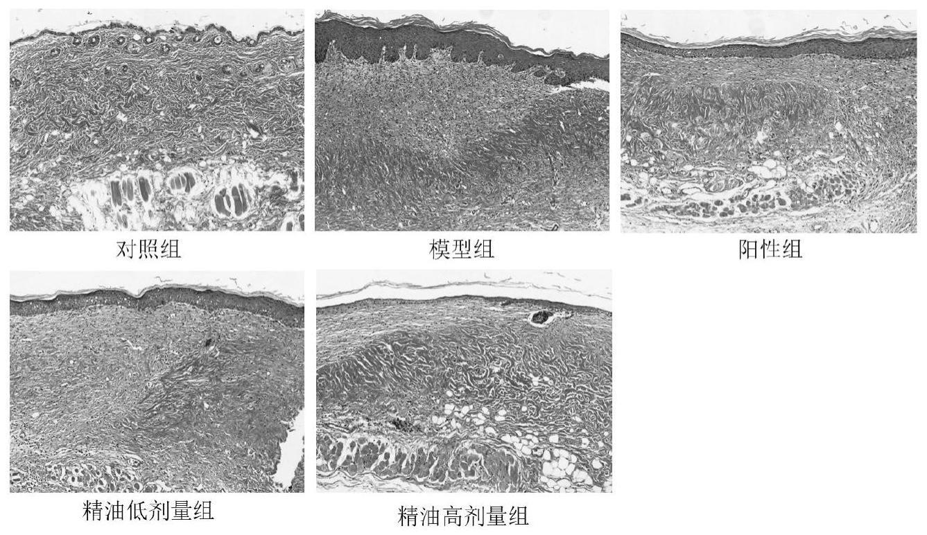 一种外用抗特应性皮炎的三草止痒配方精油、制备方法及应用