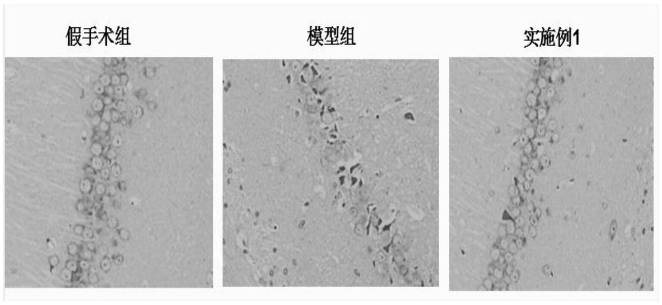 一种缓解血管性痴呆的壮医灵归巧坞方及其制备方法与流程