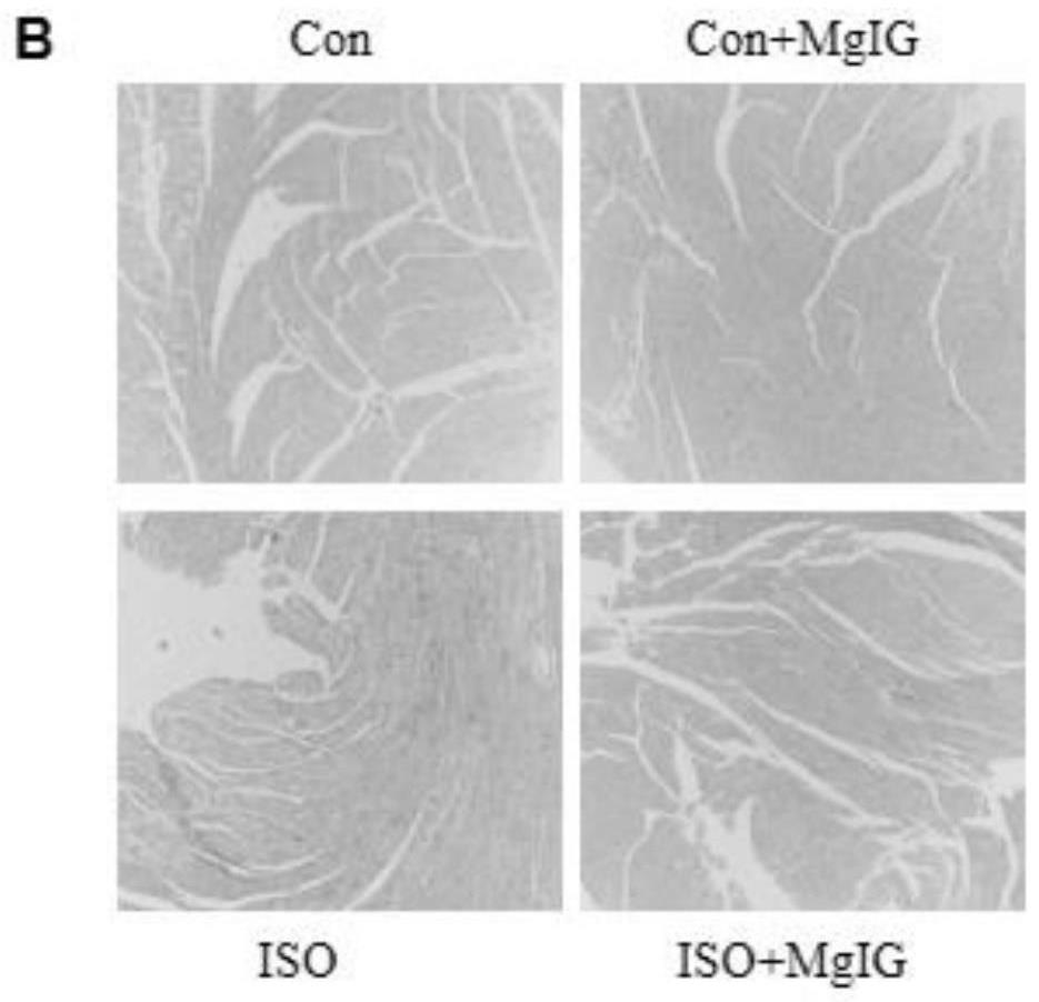 异甘草酸镁在心肌重构中的应用的制作方法