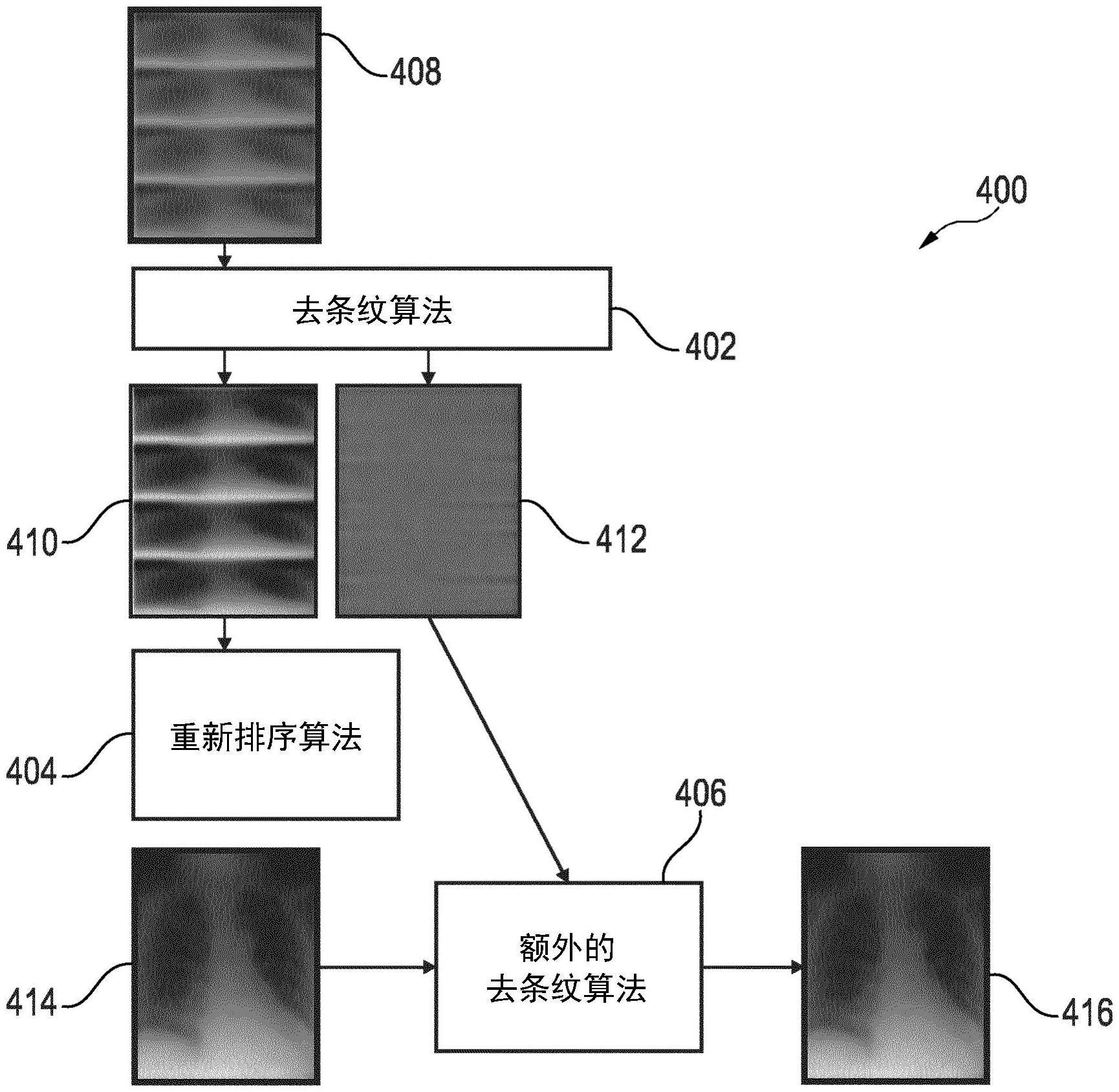 从数字图像中移除条纹噪声伪影的制作方法