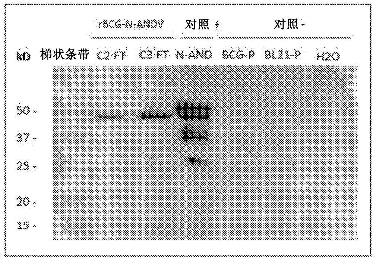 含有表达安第斯病毒(ANDV)蛋白的修饰的BCG菌株的、可用于预防和治疗汉坦-安第斯病毒感染的免疫原性制剂