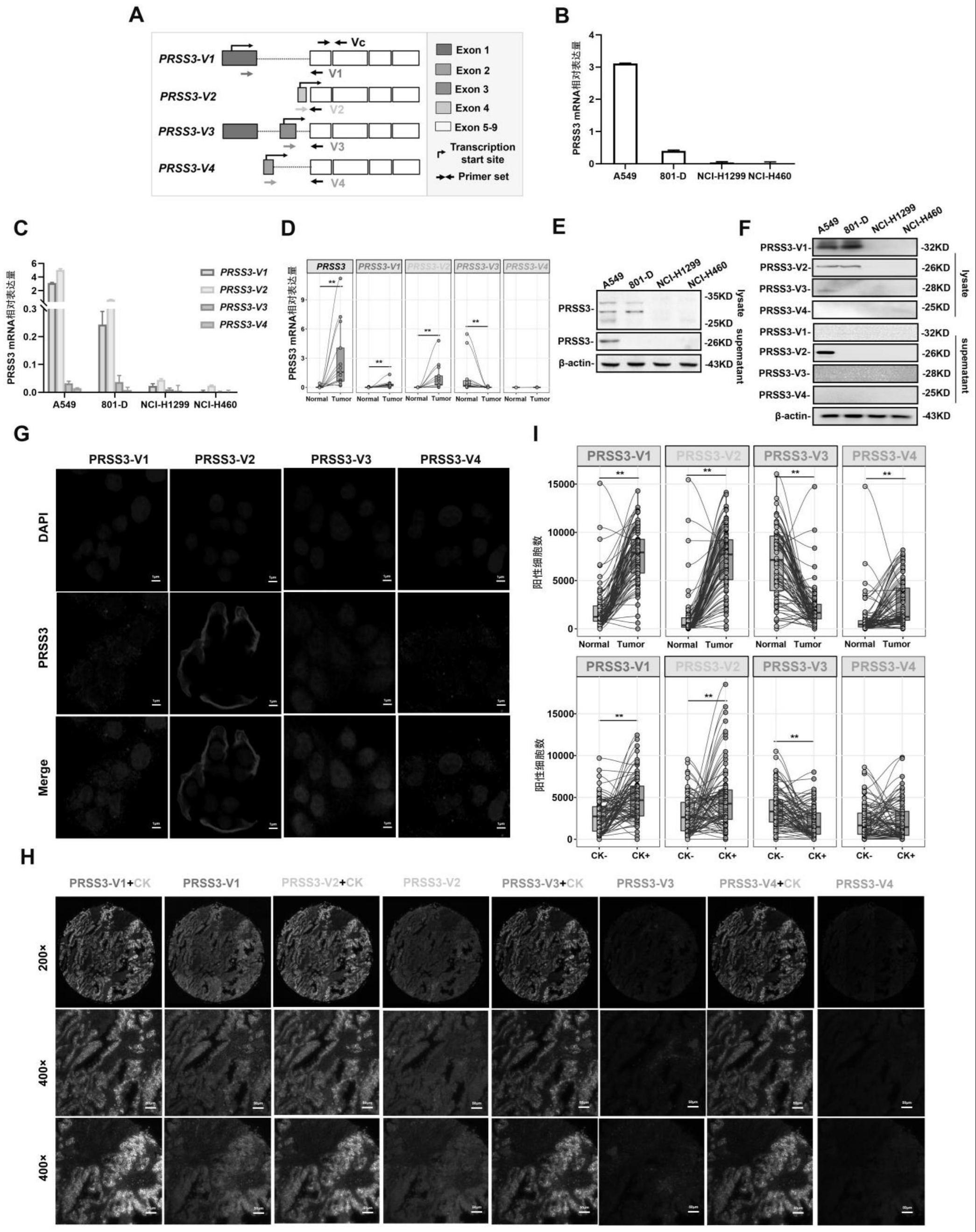 一种肺癌诊断、化疗或预后检测的分子标记物及其应用的制作方法