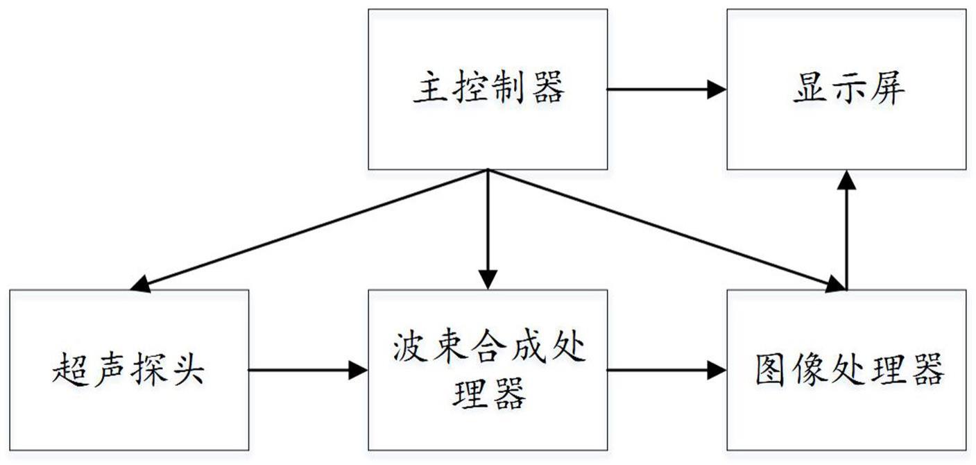 超声图像标签处理方法、装置、超声设备及存储介质与流程