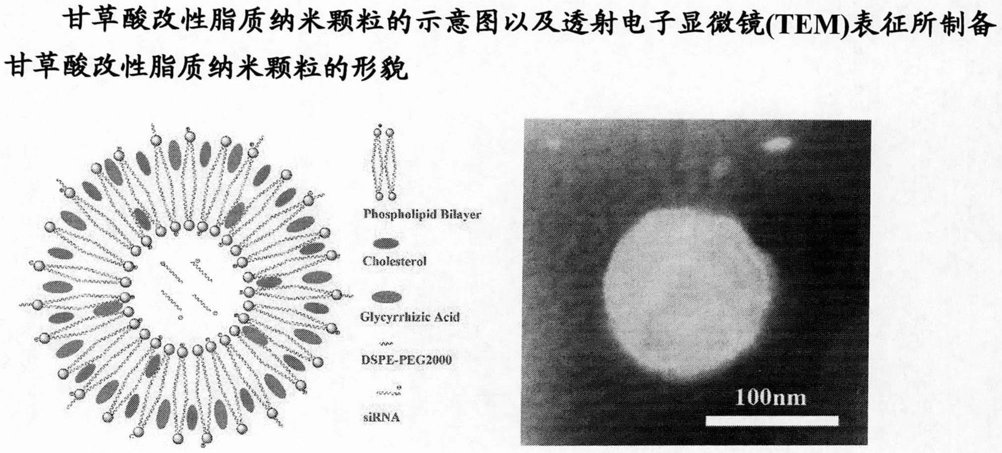 甘草酸改性脂质纳米颗粒的制备方法及其在核酸药物递送中的应用