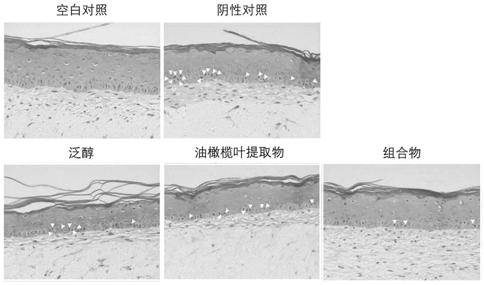 一种修护组合物及其应用的制作方法