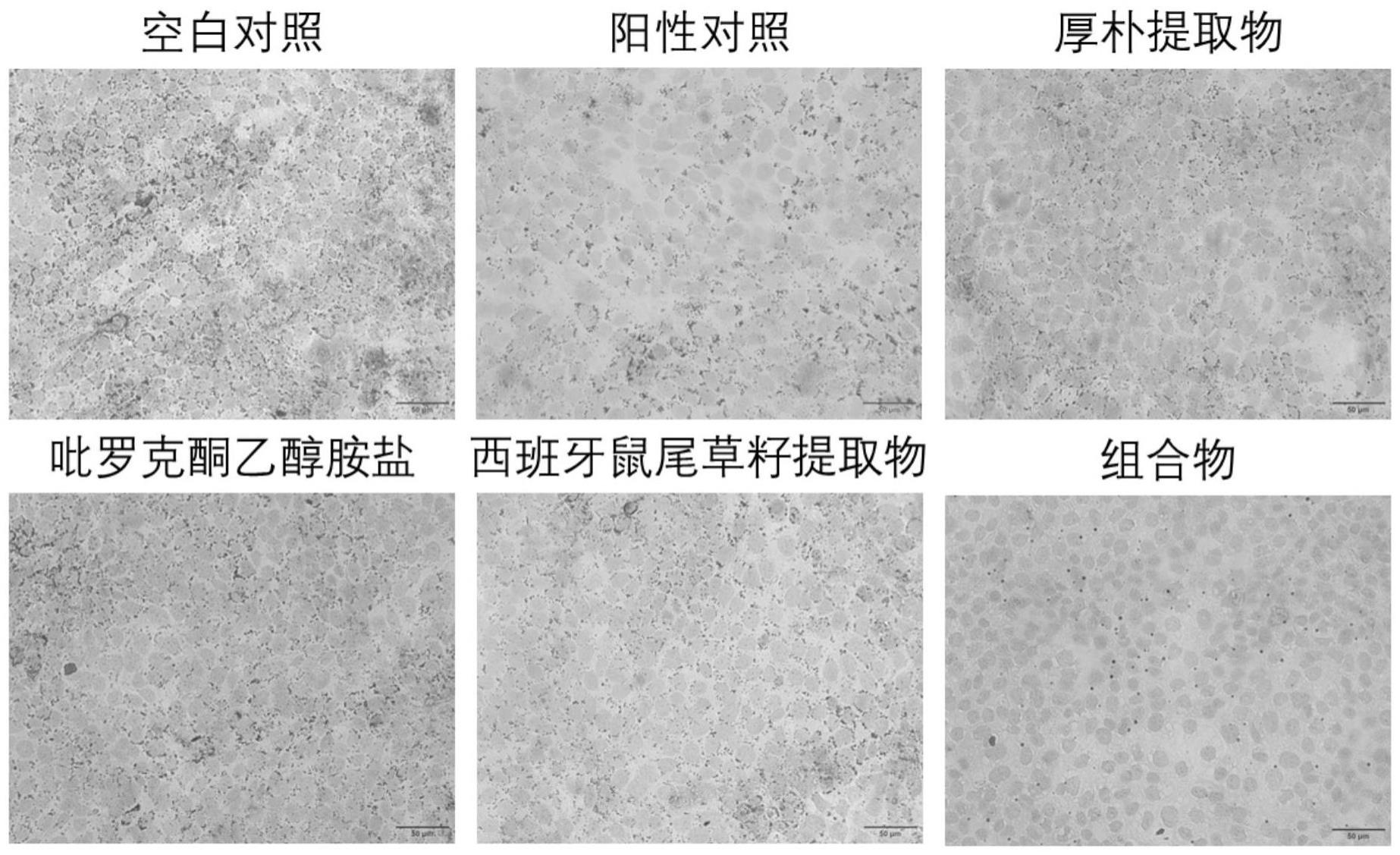 一种具有去屑控油功效的组合物及其应用的制作方法