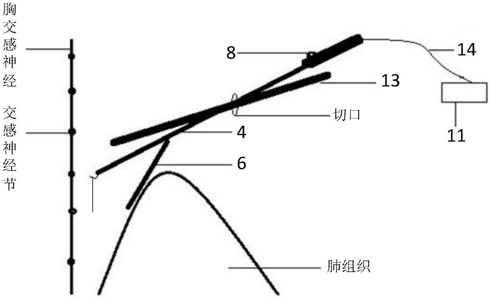 电凝钩结构及电凝钩组件的制作方法