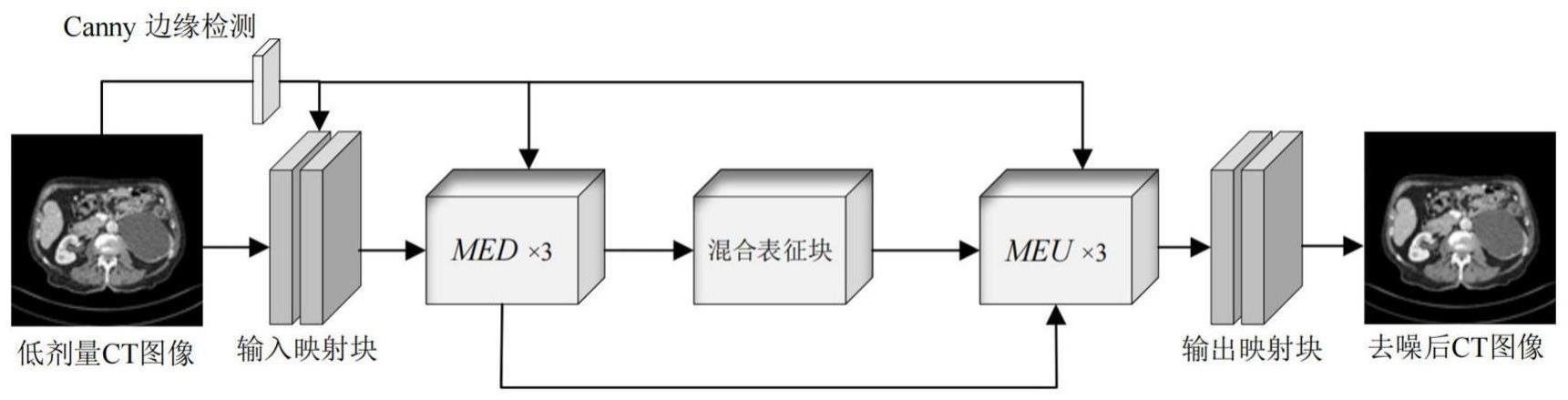 基于混合表征学习的低剂量CT图像去噪方法