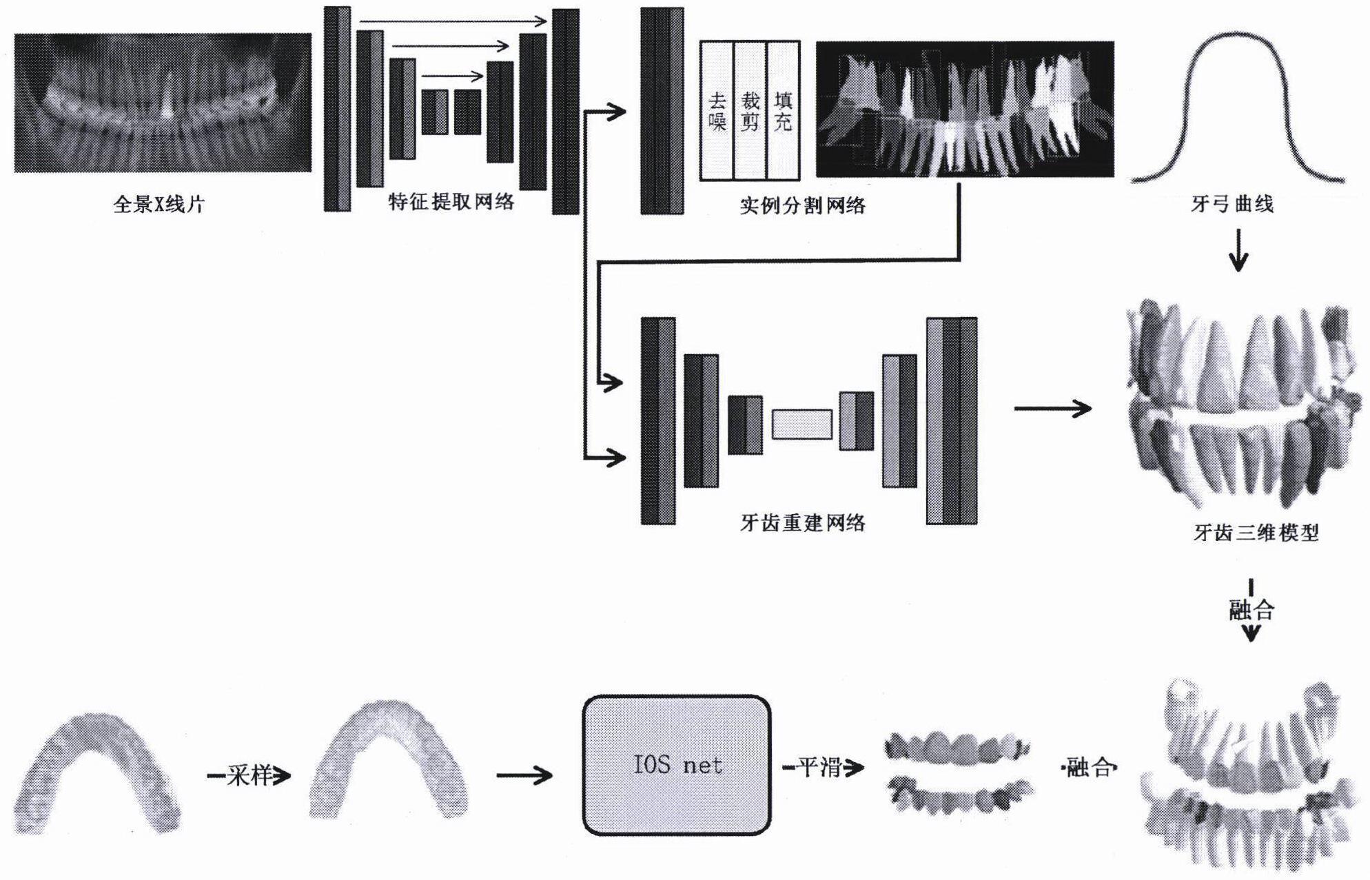 一种基于全景X线片和口扫数据的牙齿三维重建方法