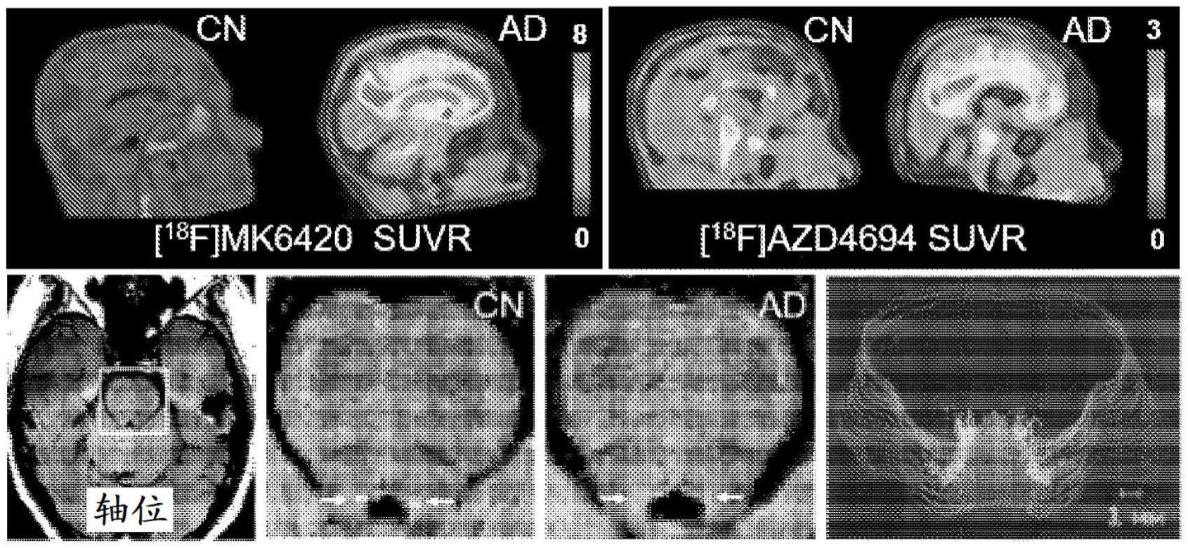 神经黑色素敏感性MRI及其使用方法