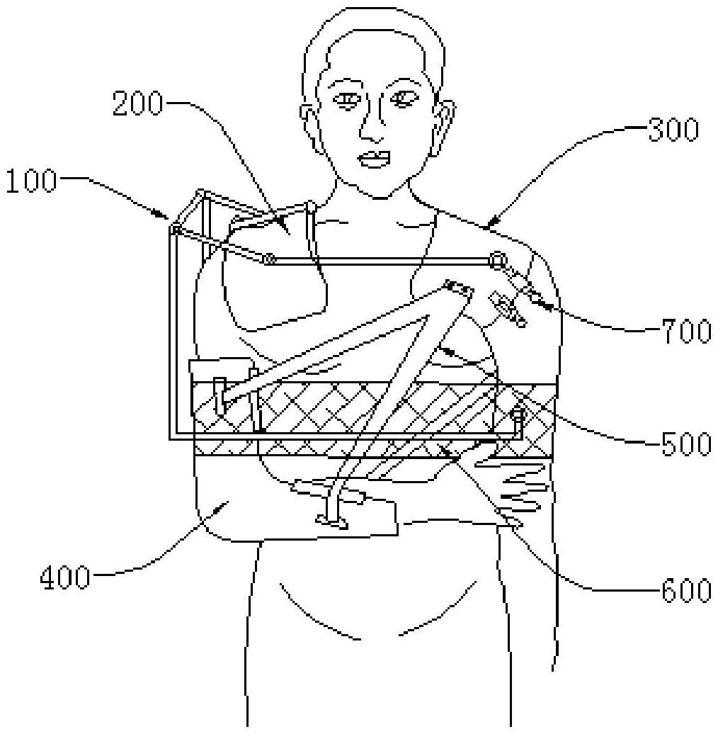 一种肩锁关节脱位固定装置的制作方法