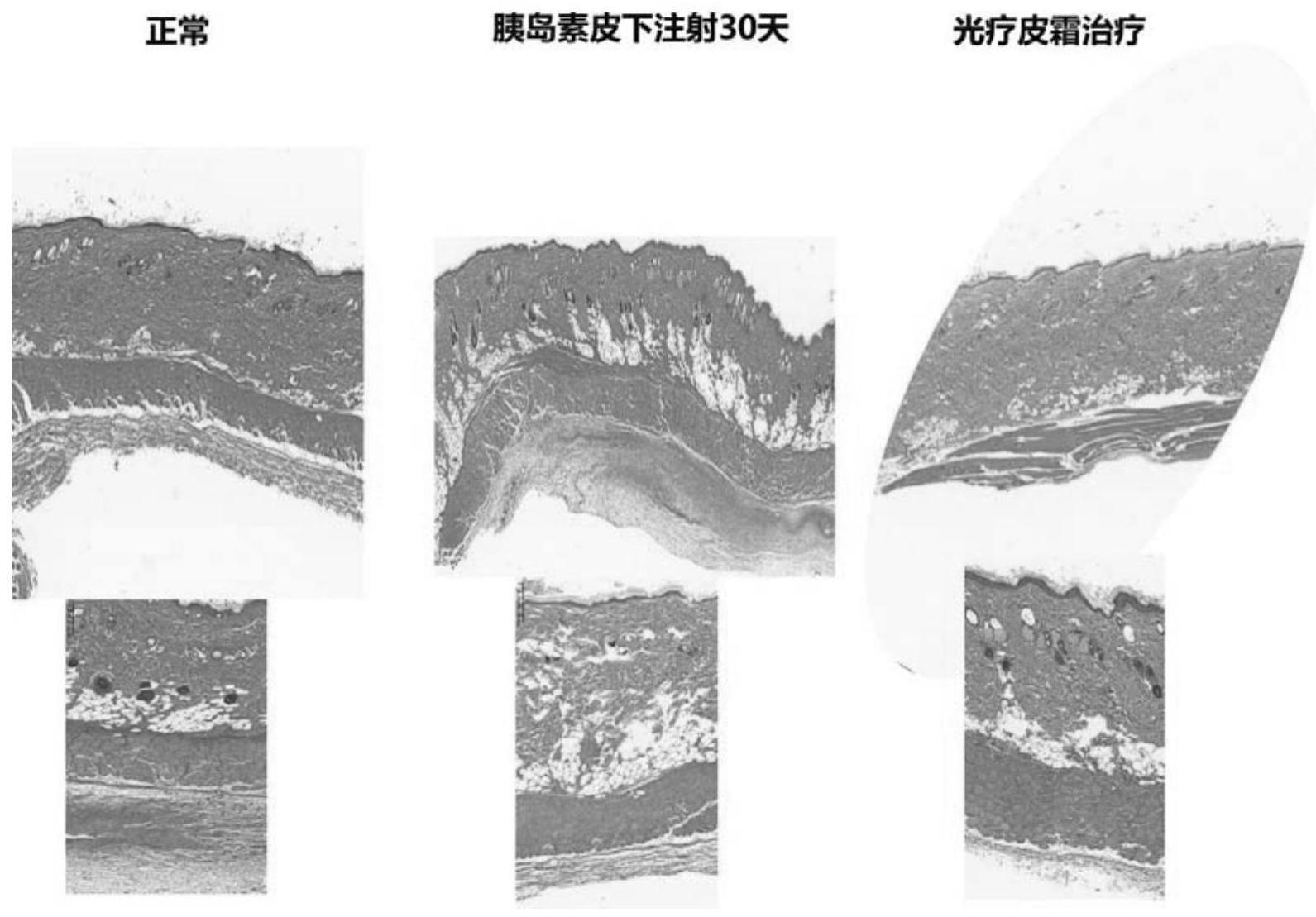 一种用于光激活治疗皮下脂肪组织增生的组合物及其制备方法