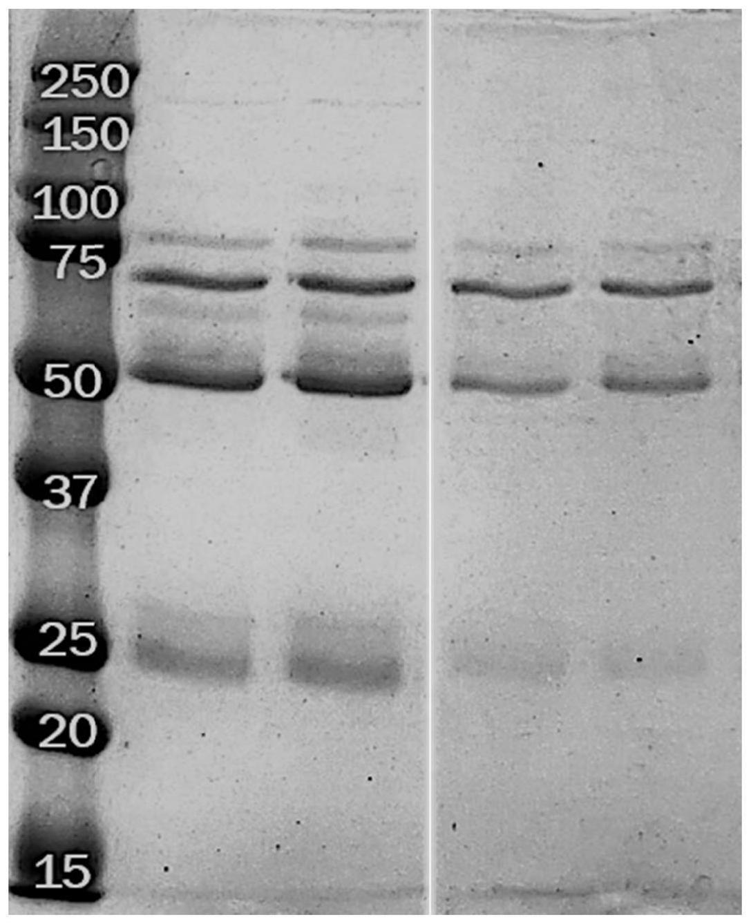 一种抗IFN-γ自身抗体的纯化工艺及其应用的制作方法