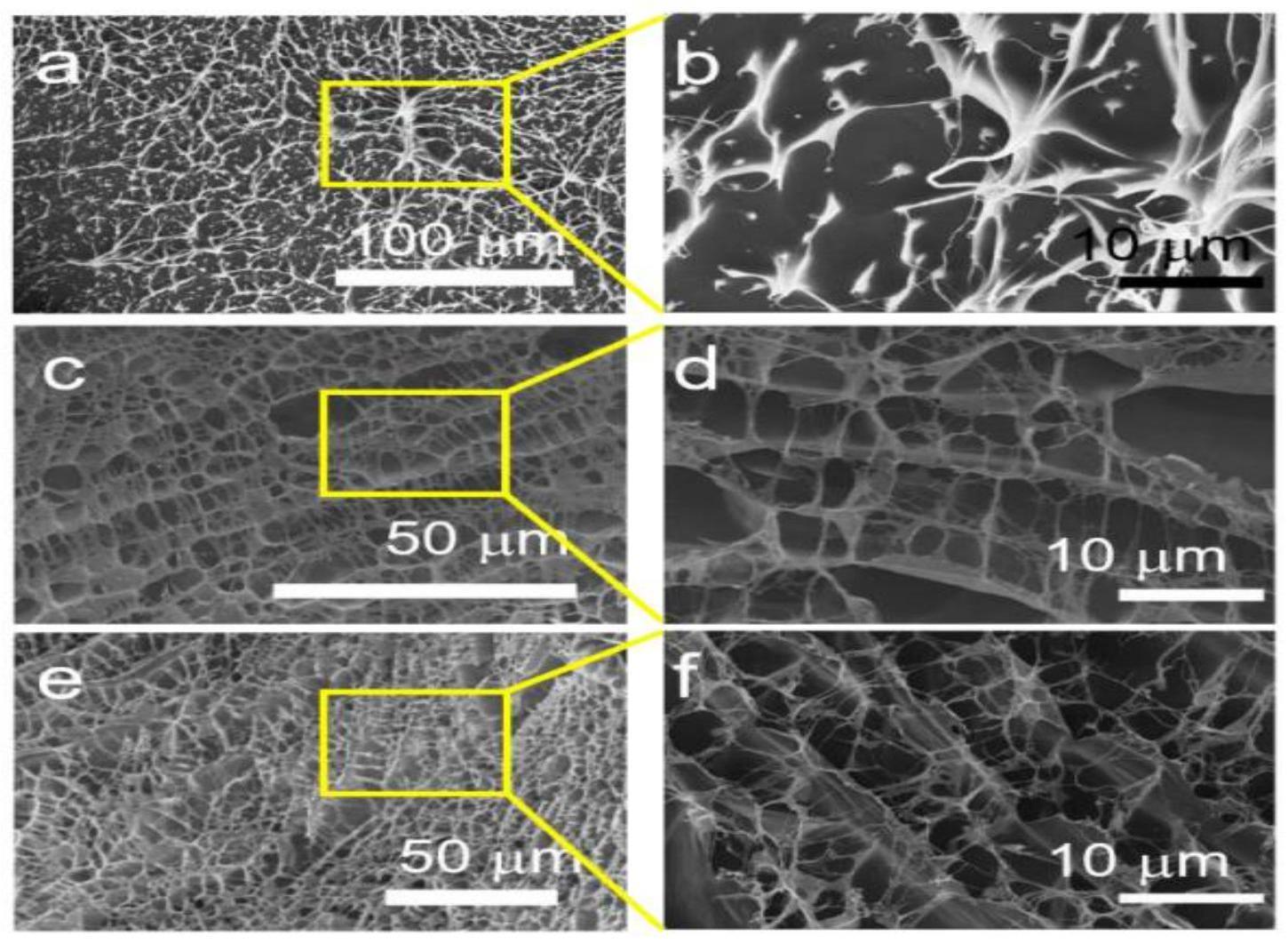 多孔碳基双载药纳米缓释材料及其子宫支架与应用