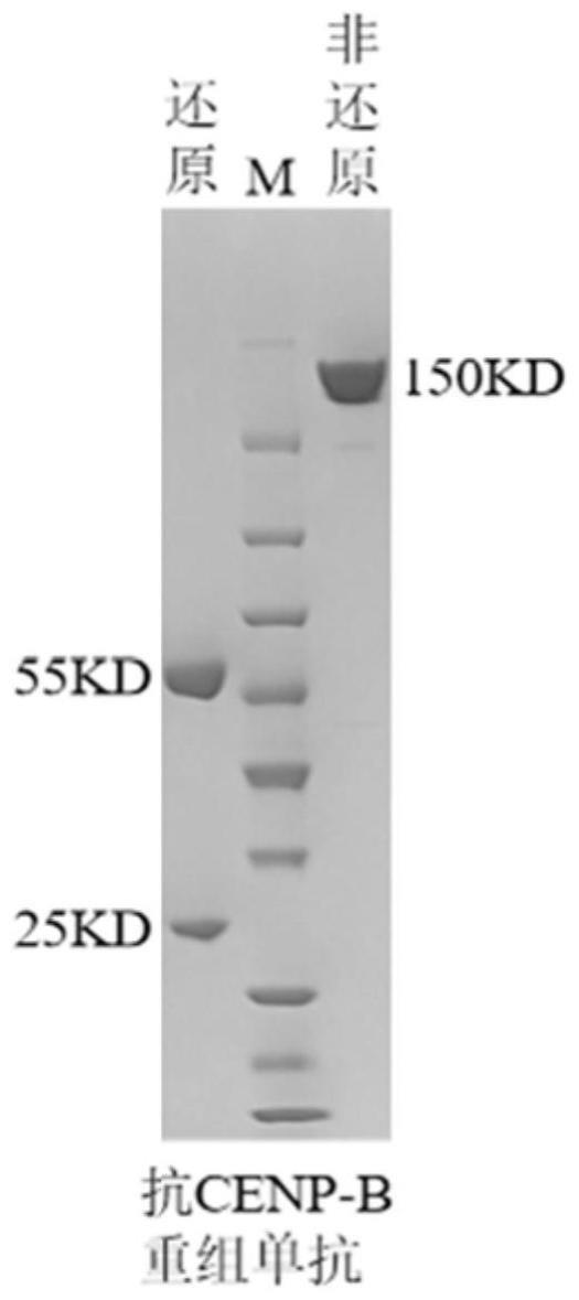 CENP-B结合蛋白、其制备方法和应用与流程