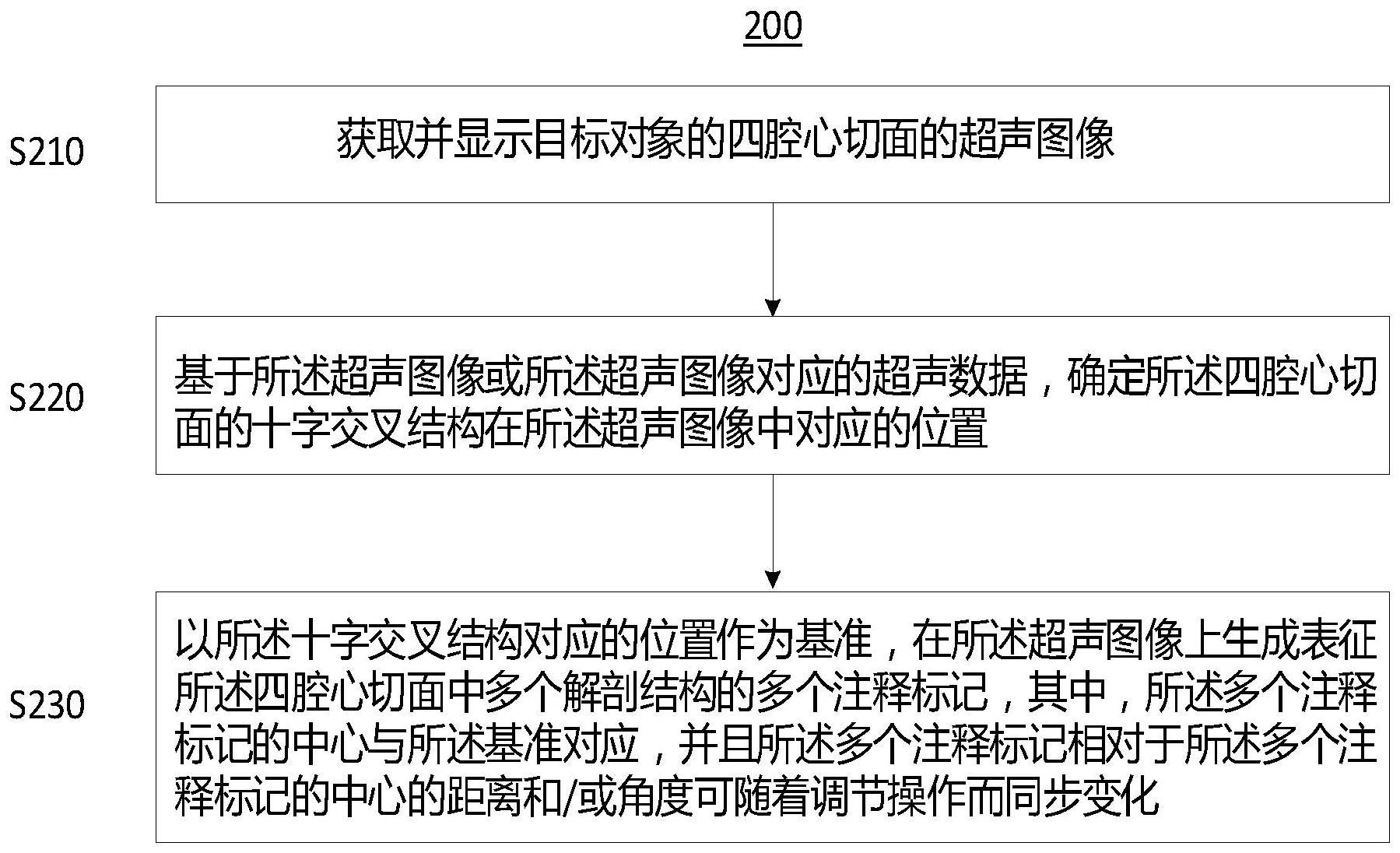 超声图像的注释方法和超声成像系统与流程