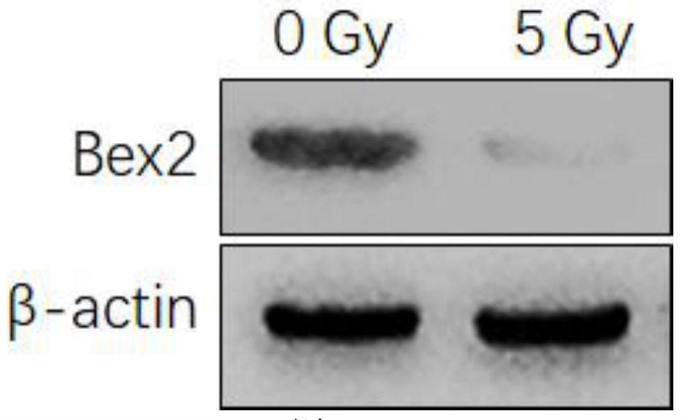 Bex2在制备治疗放疗诱导的肺纤维化的药物中的应用