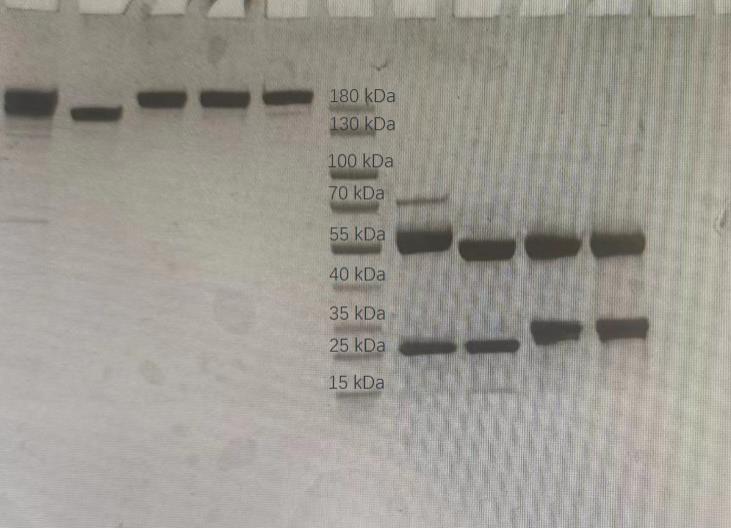 一种抗人CD25工程抗体及应用的制作方法