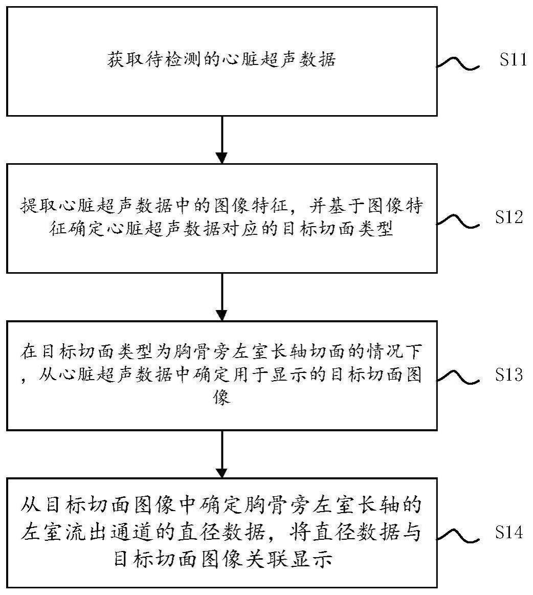 心脏超声数据的检测方法、装置、超声设备及存储介质与流程