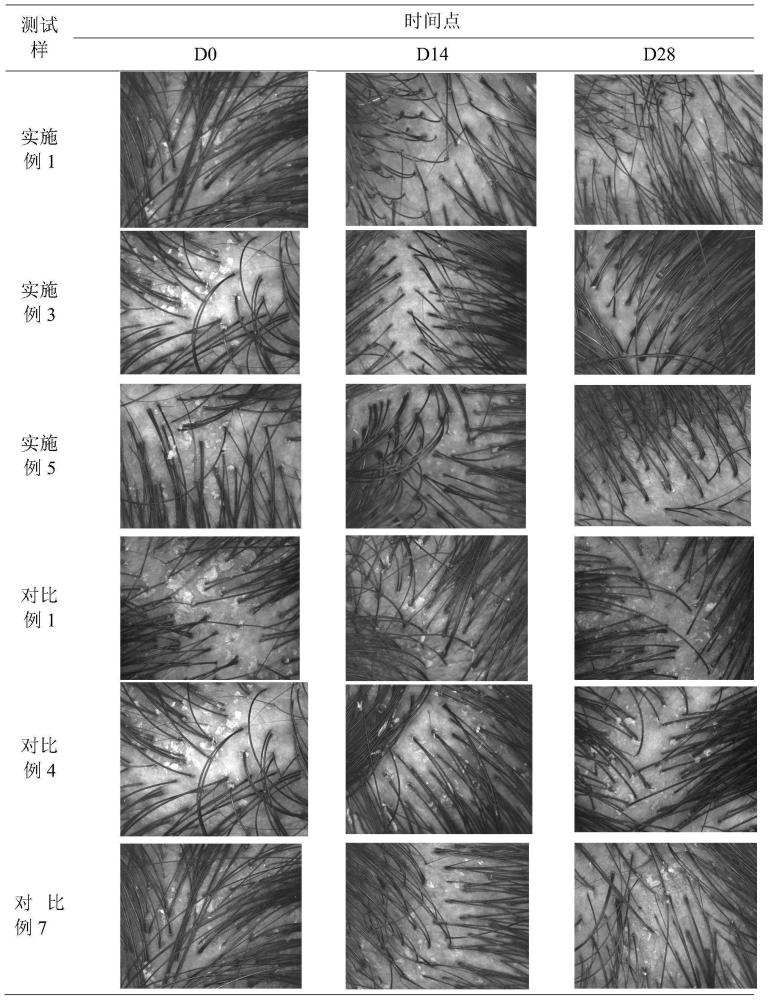 一种协同增效去屑组合物及其应用的制作方法