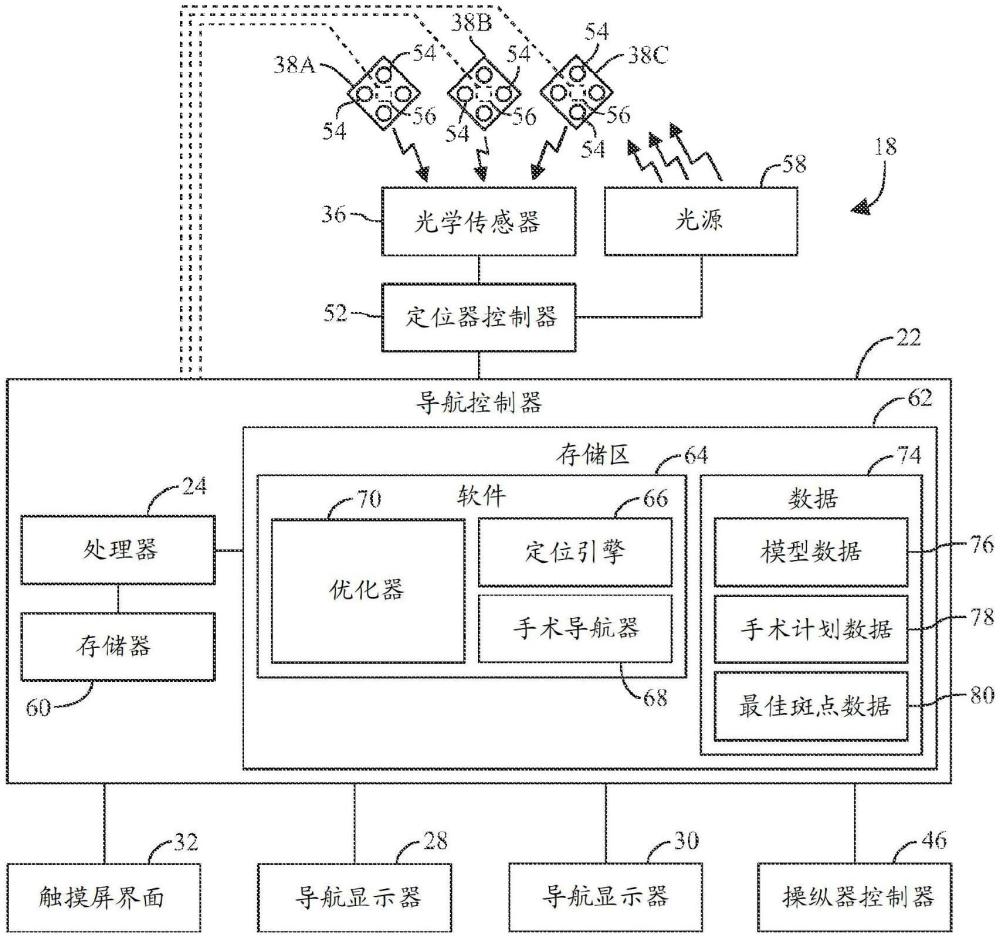 对基于跟踪器的手术导航的优化的制作方法