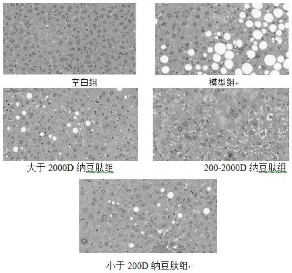 一种纳豆肽及其制备方法和应用与流程