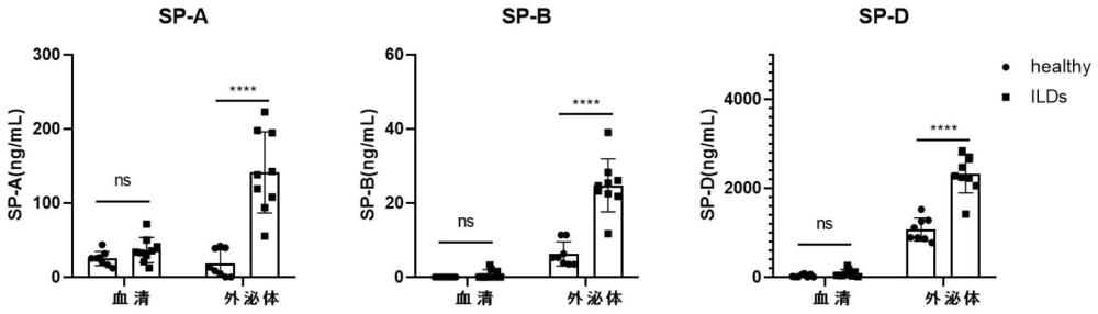 外泌体上表面活性物质在制备辅助诊断间质性肺疾病产品中的应用的制作方法