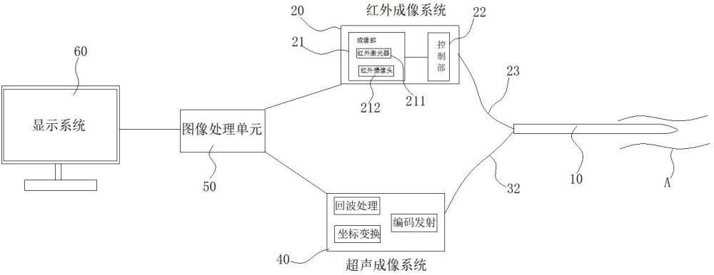 红外血管成像系统的制作方法