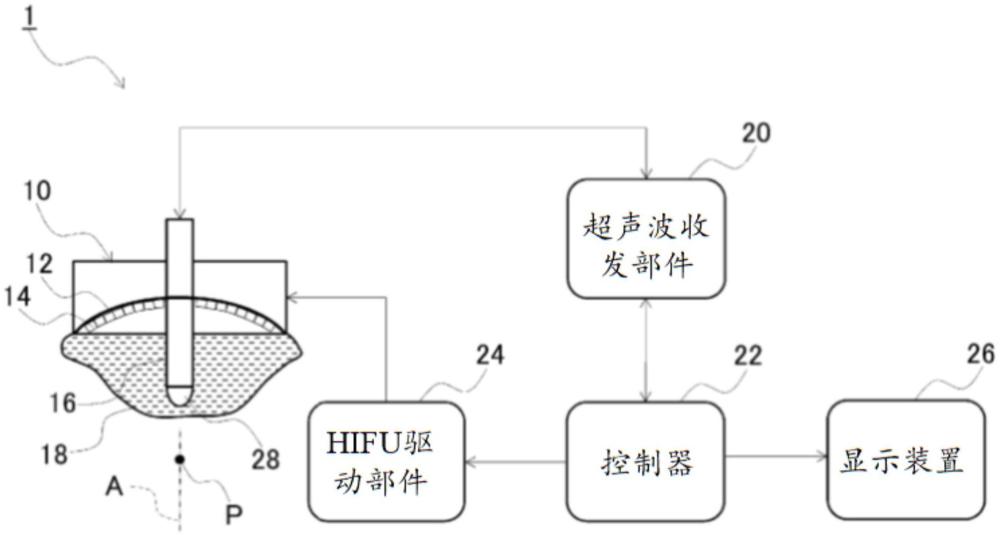 超声波图像处理装置的制作方法