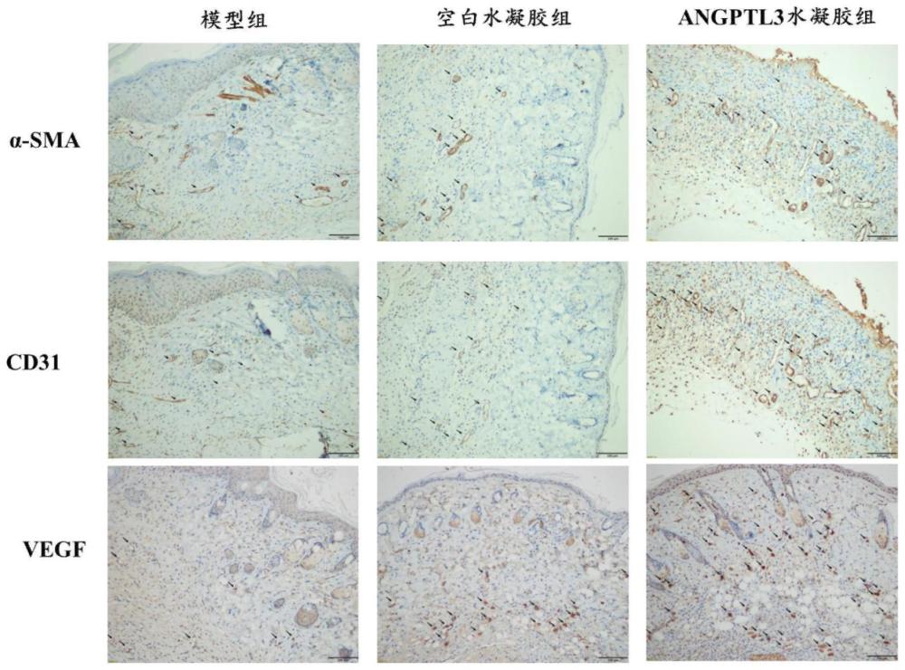 负载血管生成素样蛋白3的水凝胶及其制备方法与应用