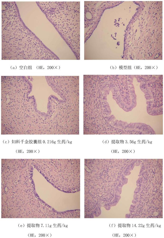 一種中藥組合物及其制備方法和應(yīng)用與流程