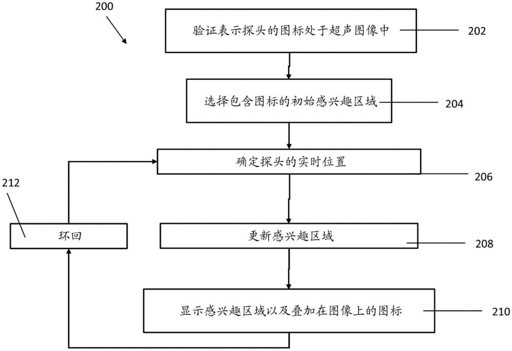 在四維超聲圖像中使醫(yī)療探頭可視化的制作方法