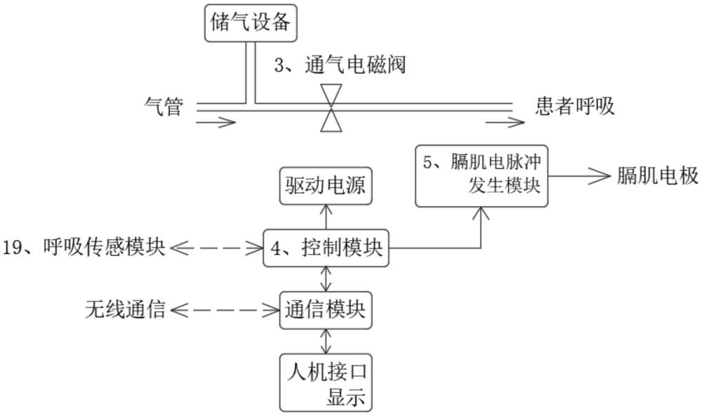 儲氣式同步通氣膈肌起搏器的制作方法