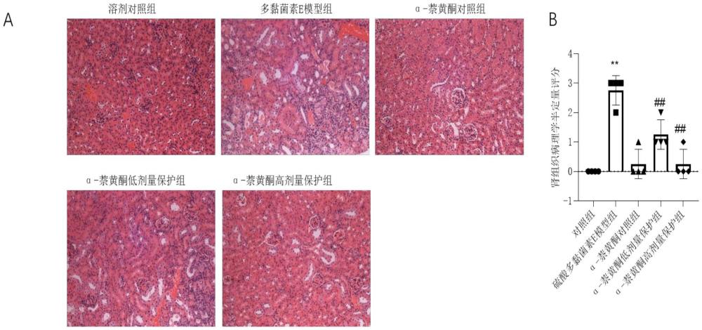 α-萘黃酮在制備降低多黏菌素細胞毒性藥物和/或臟器毒性藥物中的應用、藥物組合物及應用