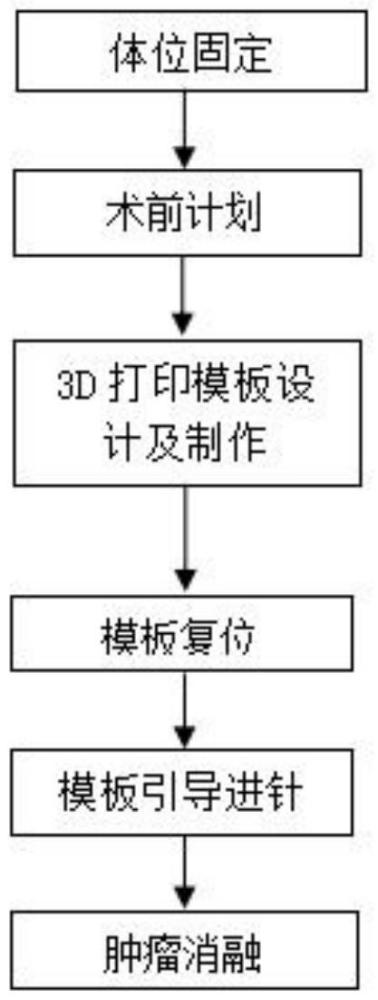 一種基于3D打印模板的精準(zhǔn)消融腫瘤的方法