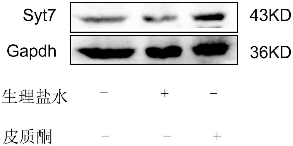 Synaptotagmin7作為靶點(diǎn)在治療應(yīng)激誘導(dǎo)心肌損傷中的應(yīng)用