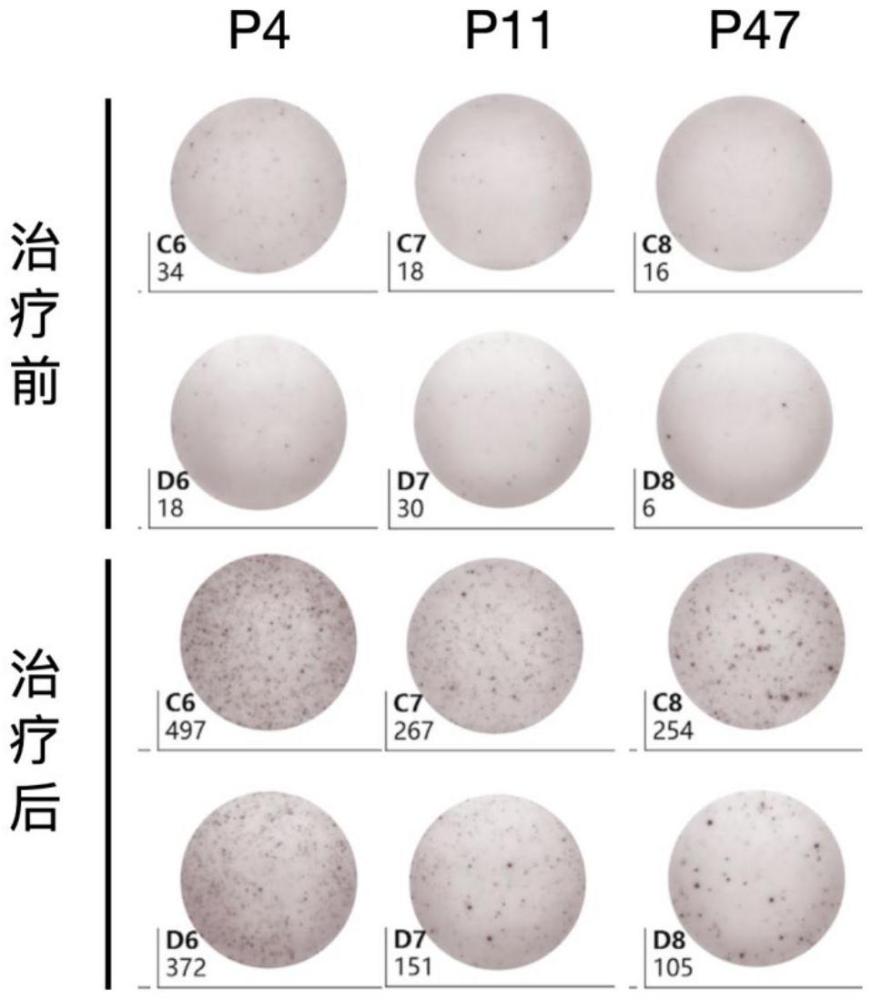 針對KIF5B-ALK融合基因的腫瘤新抗原多肽及其應用