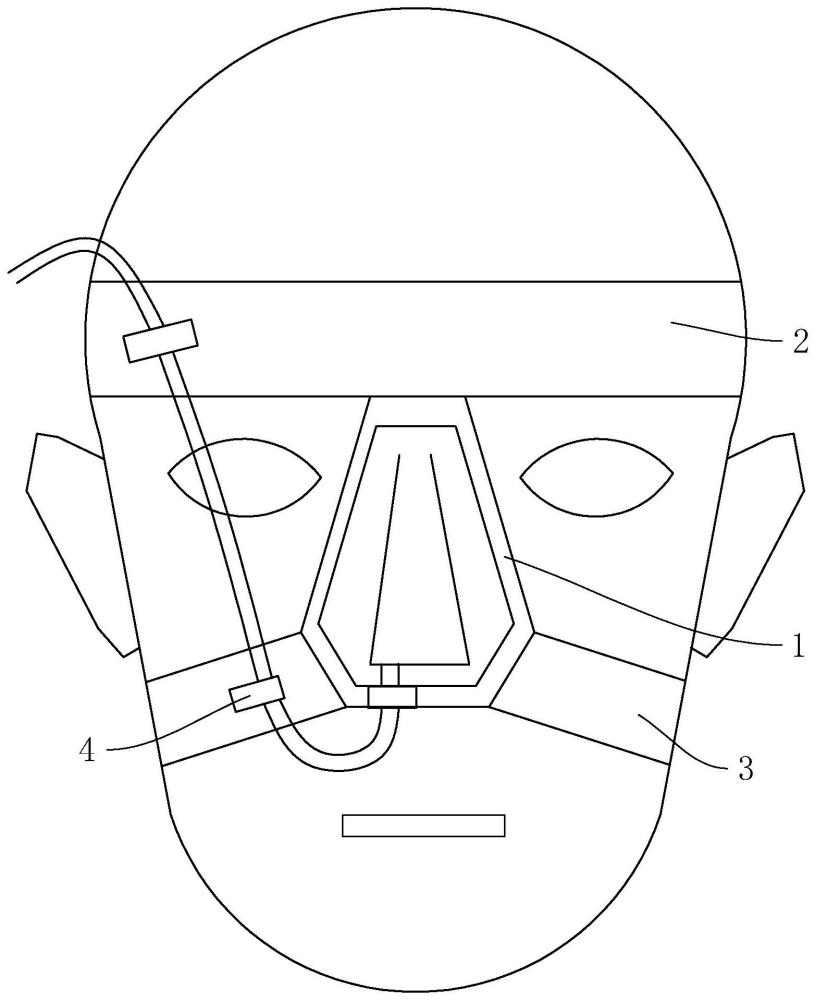 一種鼻胃管固定面罩的制作方法