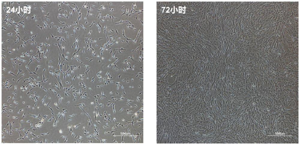 一種干細胞冷藏保存液及其制備方法與應用與流程