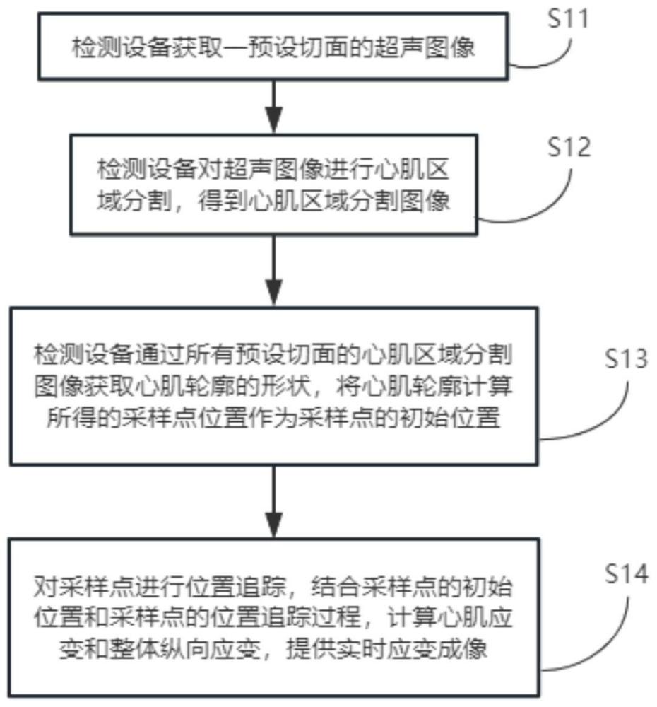 心肌弹性应变测量方法、超声系统、计算机存储介质与流程