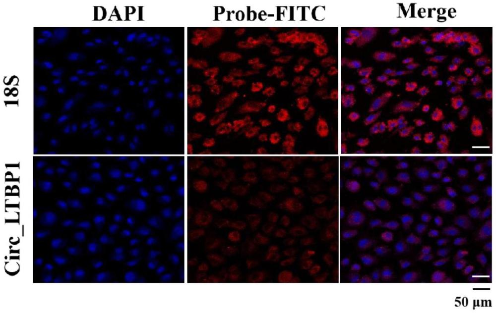 一種環(huán)狀RNA circ_LTBP1在促進(jìn)綿羊卵泡發(fā)育及輔助育種中的應(yīng)用