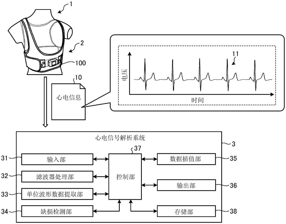 心電信號解析系統(tǒng)的制作方法