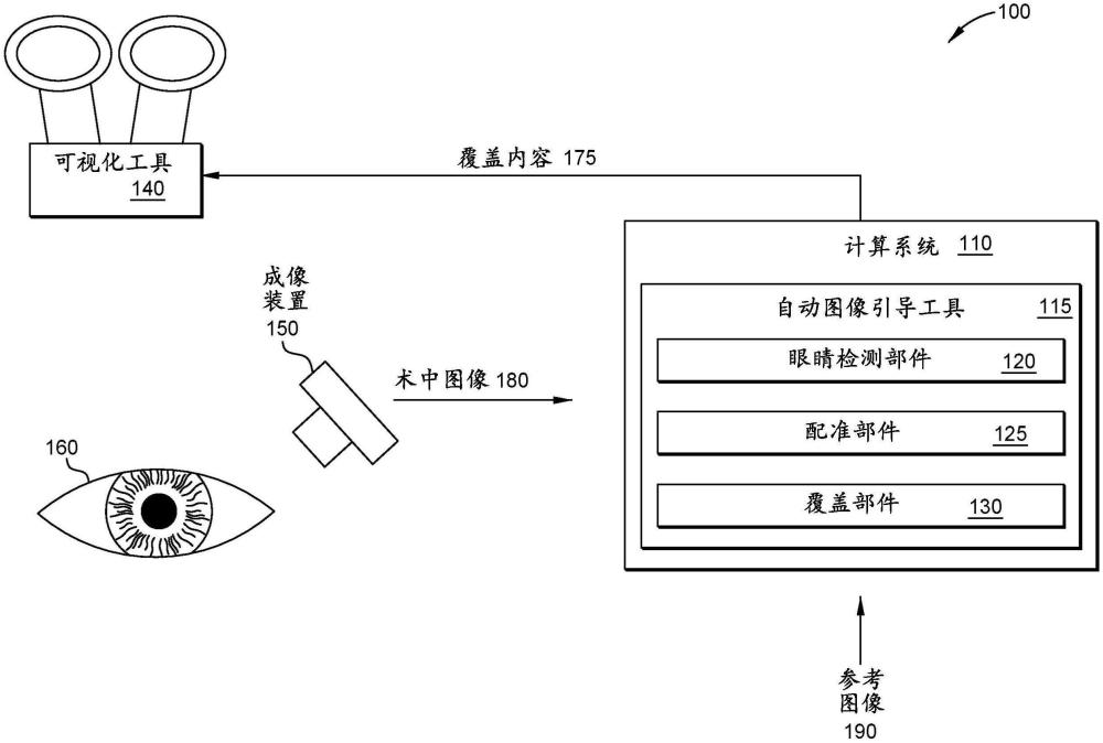 用于眼科手術(shù)的自動(dòng)圖像引導(dǎo)的制作方法