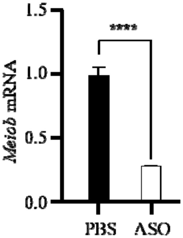 MEIOB基因的突變檢測引物組、靶向其mRNA的反義寡核苷酸以及針對MEIOB蛋白的小分子藥物及應(yīng)用