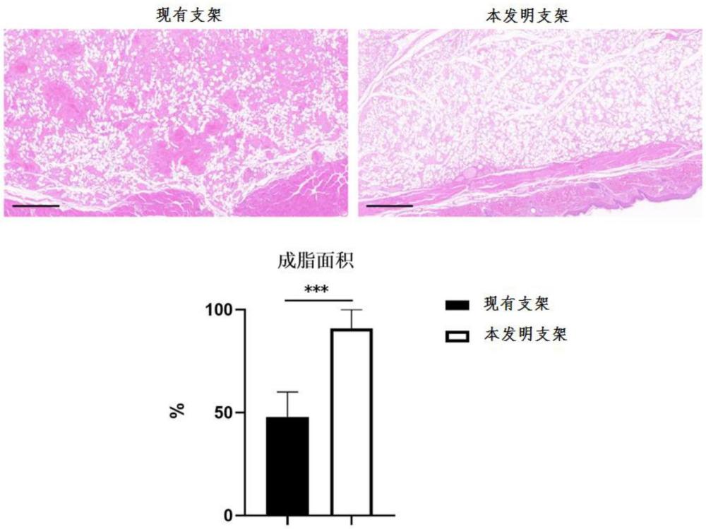 一種親水性脂肪來源脫細胞基質(zhì)支架及其制備方法和應(yīng)用