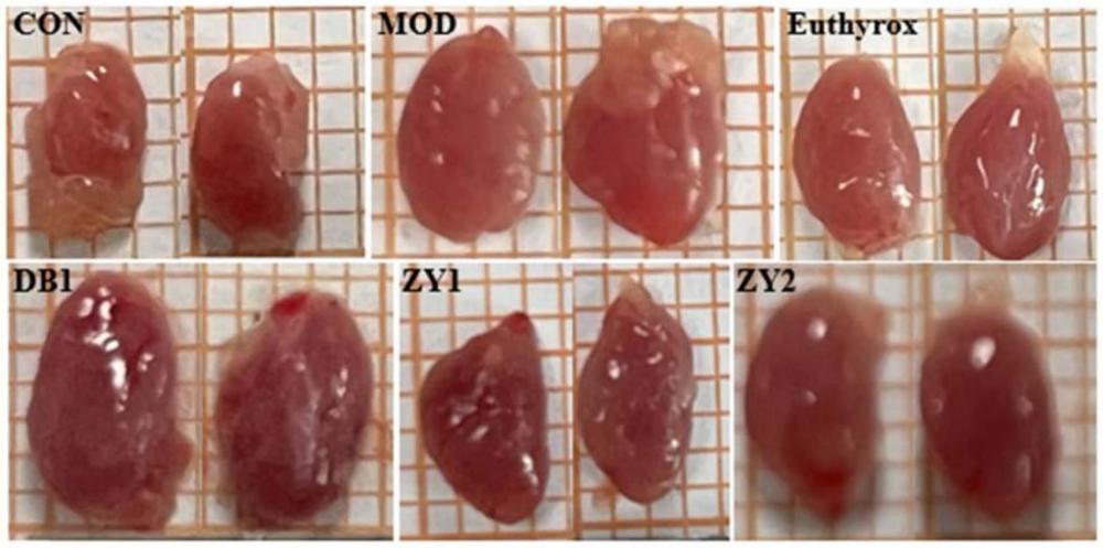 一種中藥組合物及其制備方法和在制備防治甲狀腺疾病藥物中的應(yīng)用