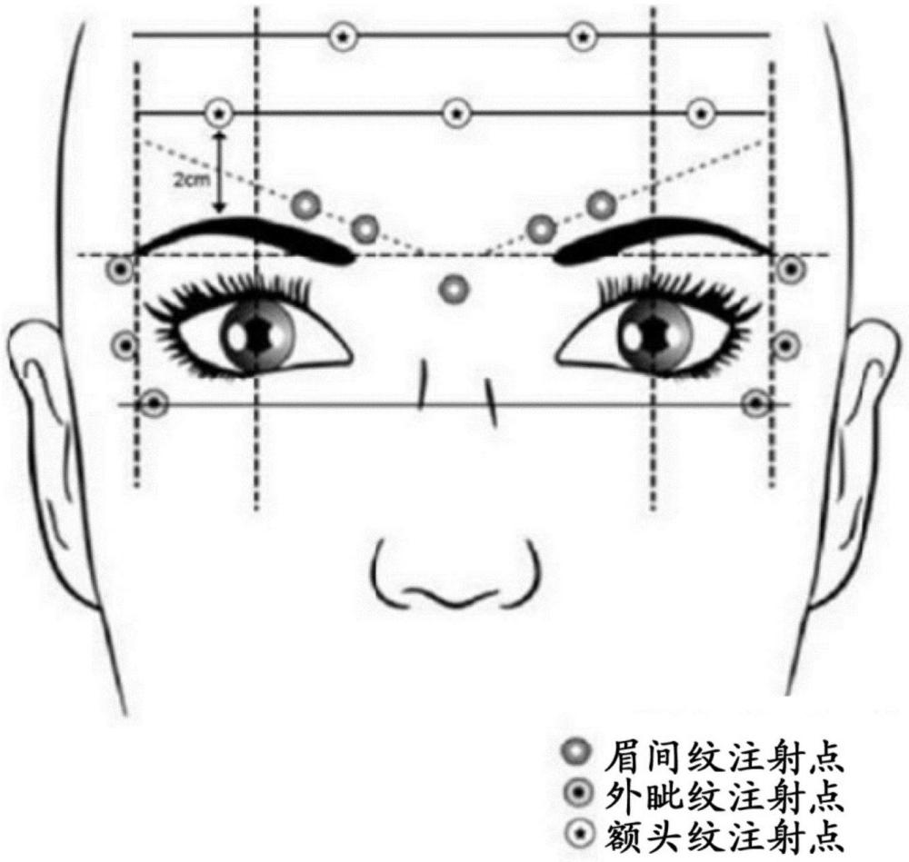 上面部紋的治療的制作方法