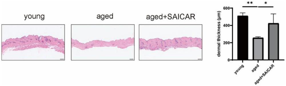化合物SAICAR在制備改善皮膚衰老產(chǎn)品中的用途