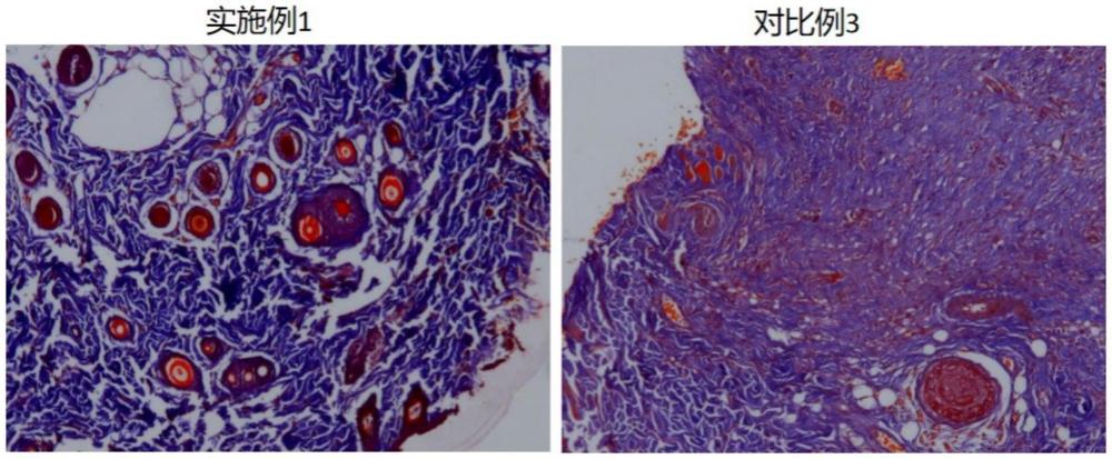 一種可注射膠原復(fù)合水凝膠及其制備方法和應(yīng)用與流程