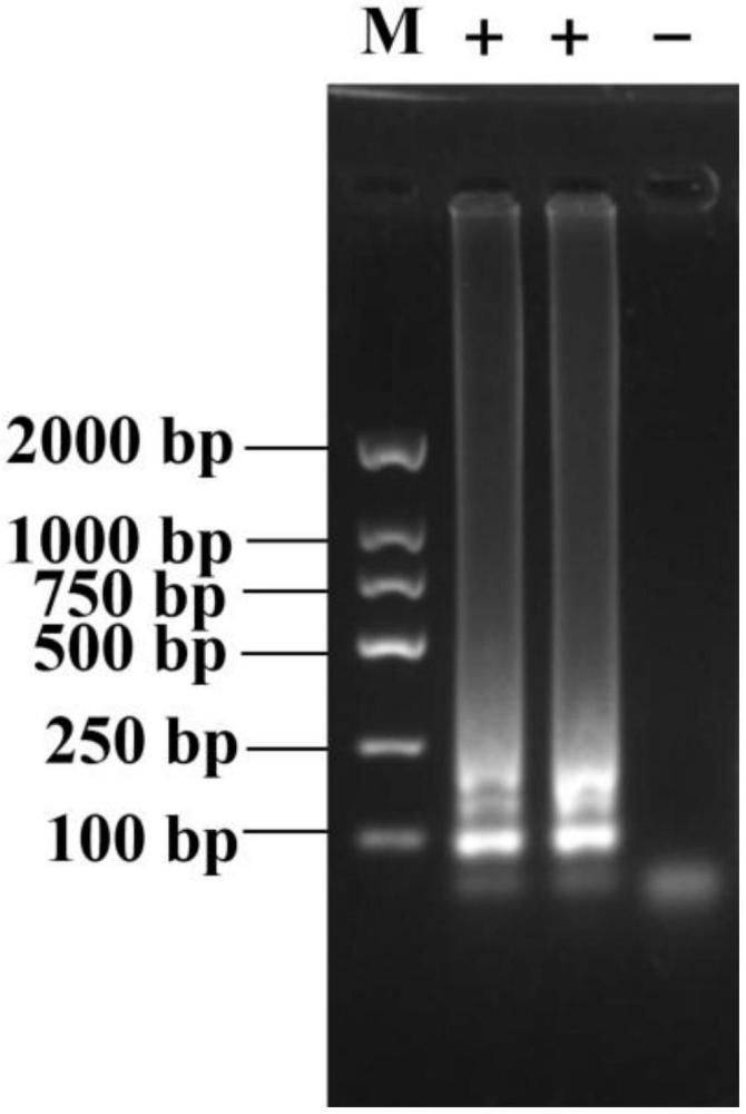 一種基于RT-LAMP-Cas14a無(wú)PAM限制的水產(chǎn)神經(jīng)壞死病毒檢測(cè)方法